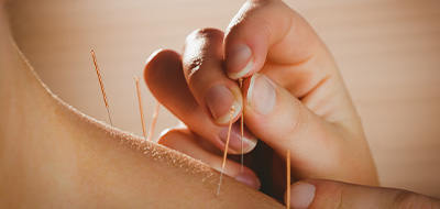 訪問での指圧・はり灸を行っております